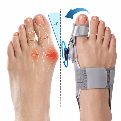 ToeAlign™ - Bunion Corrector